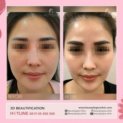 1_3D-BEAUTIFICATION-02