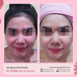3D-BEAUTIFICATION