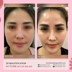 3D-BEAUTIFICATION-02