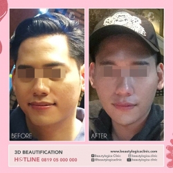 3D-BEAUTIFICATION-03