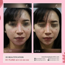 3D-BEAUTIFICATION-04