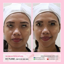 3D-BEAUTIFICATION-05