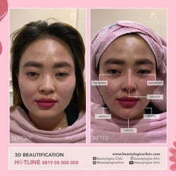 3D-BEAUTIFICATION-06