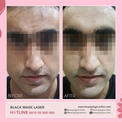 BLACK-MASK-LASER-08
