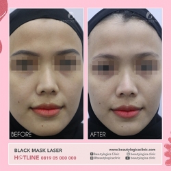 BLACK-MASK-LASER-11