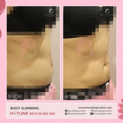 BODY-SLIMMING-03