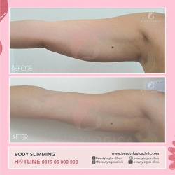 BODY-SLIMMING-04