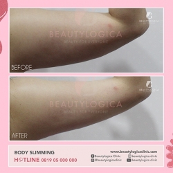 BODY-SLIMMING-05