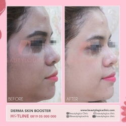 DERMA-SKIN-BOOSTER-05