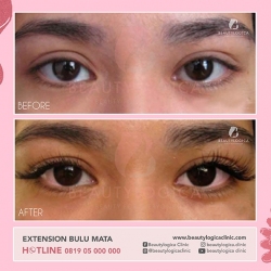 EXTENSION-BULU-MATA-01
