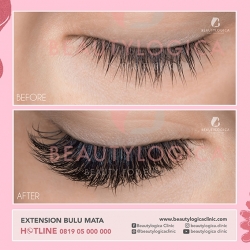 EXTENSION-BULU-MATA-02