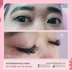 EXTENSION-BULU-MATA-03