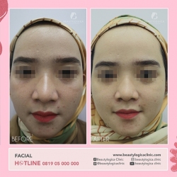 FACIAL-01