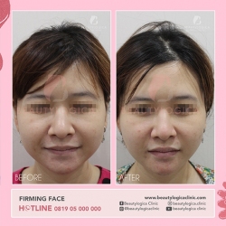 FIRMING-FACE-01