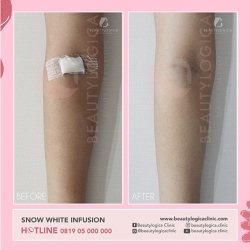 SNOW-WHITE-INFUSION-05