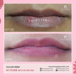 SULAM-BIBIR-01