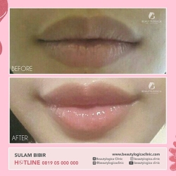 SULAM-BIBIR-02
