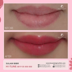 SULAM-BIBIR-03