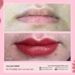 SULAM-BIBIR-04