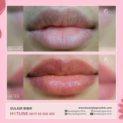 SULAM-BIBIR-05