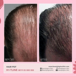 1_HAIR-PDT-01