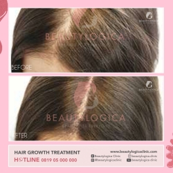 HAIR-STEMCELL-01