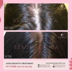 HAIR-STEMCELL-08