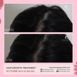 HAIR-STEMCELL-09