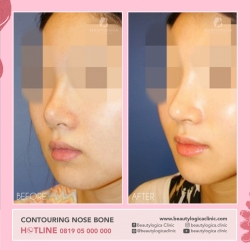 CONTOURING-NOSE-BONE-01