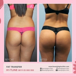 FAT-TRANSFER-01