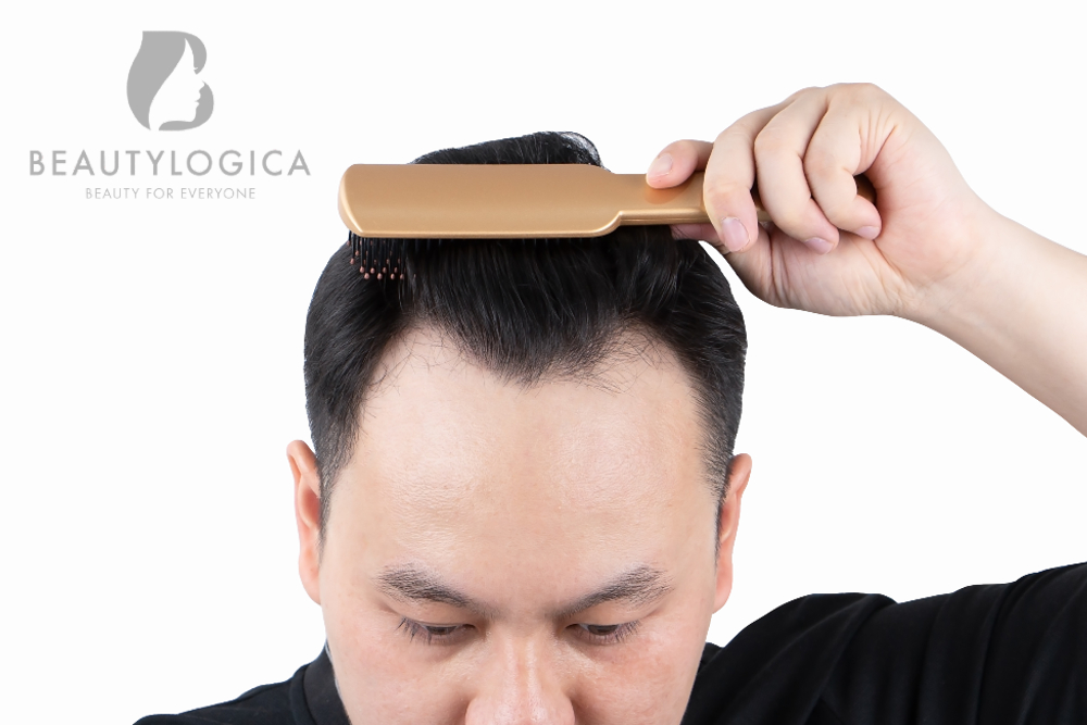 6 Cara Menumbuhkan Rambut Botak Paling Ampuh