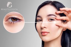 Harga Filler Kantung Mata