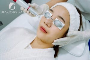 Harga Laser Wajah Jerawat