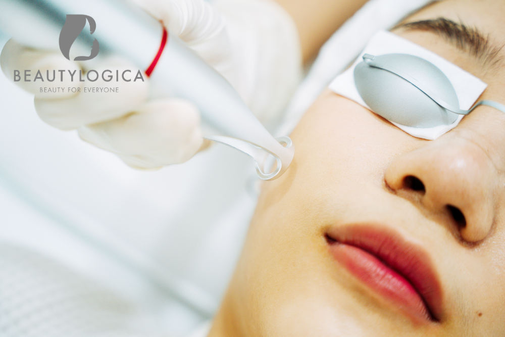 Harga Laser Wajah di Medan Murah