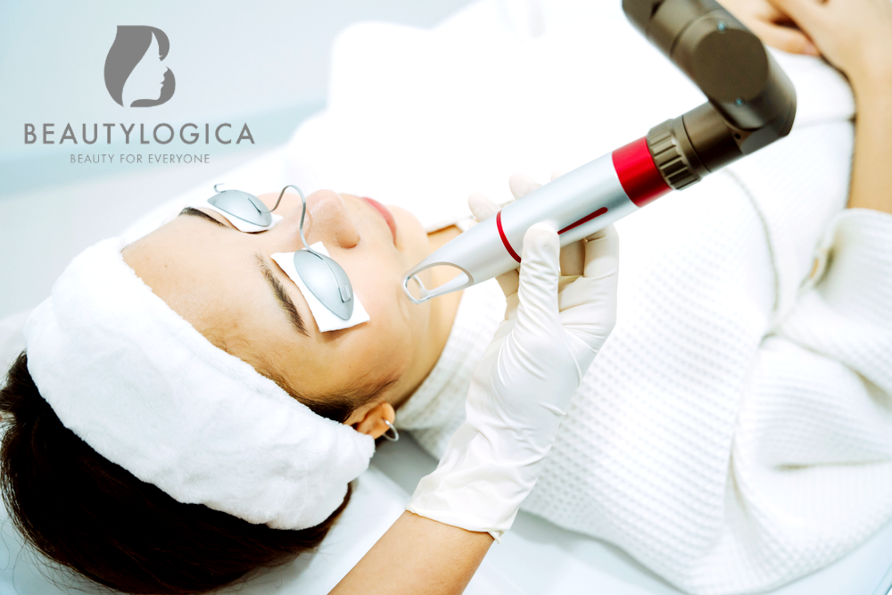 Harga Laser Wajah di Medan