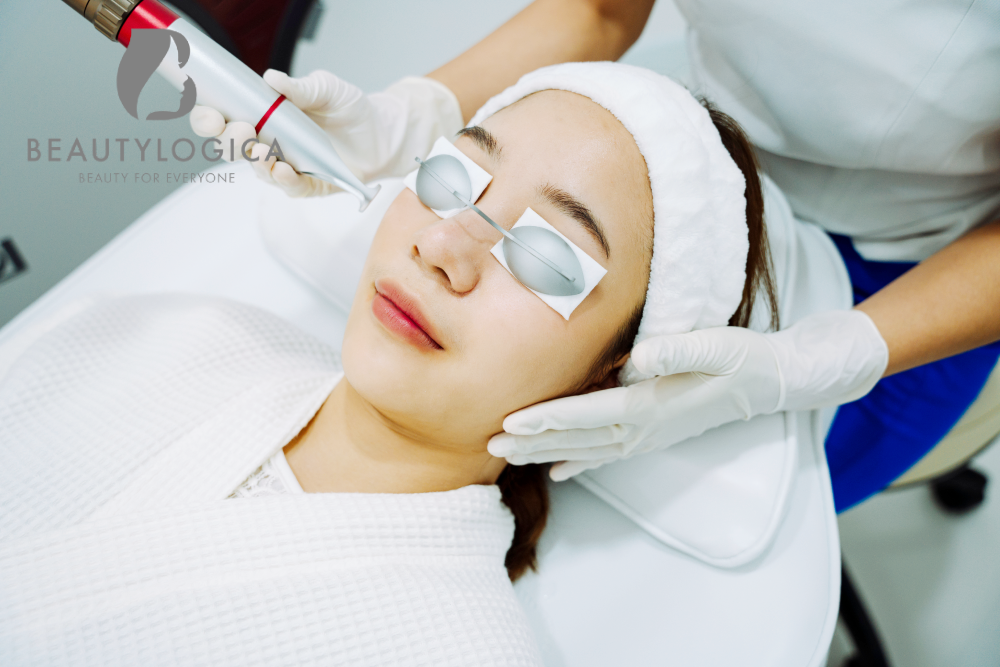 Laser Wajah Murah di Kota Medan