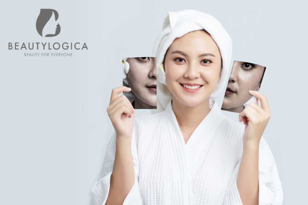 Tempat Facial Murah di Jakarta Barat