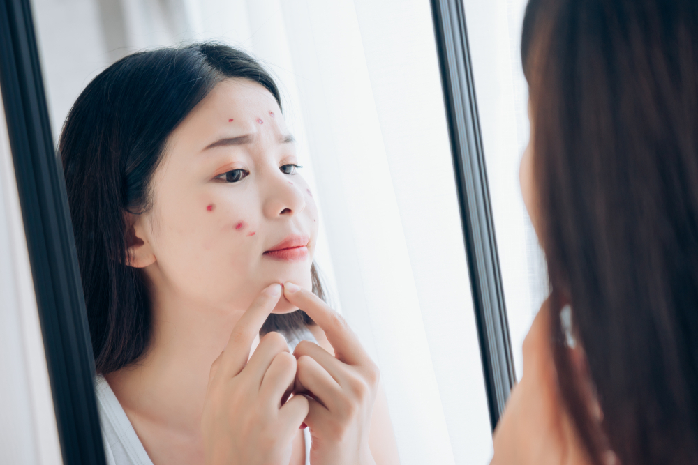Tips atasi jerawat meradang di klinik kecantikan