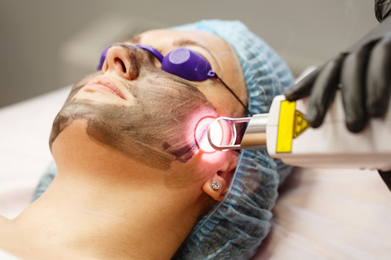 Black mask laser
