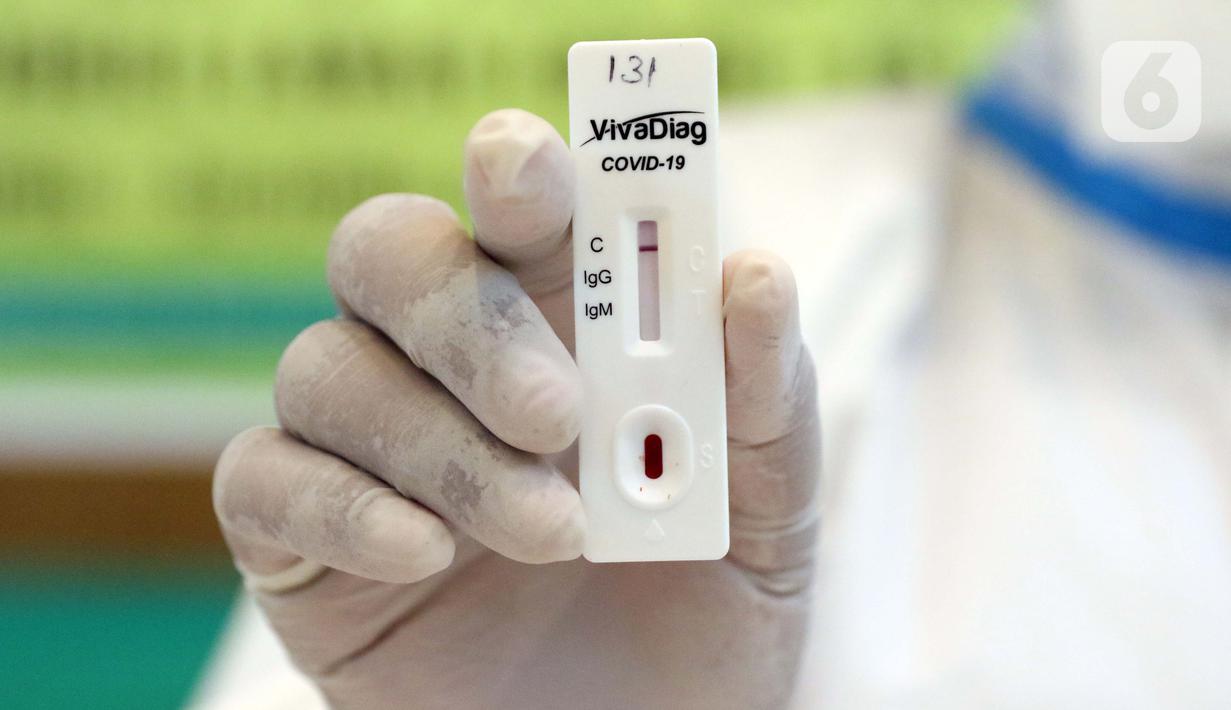 Rapid Test Murah dan Aman