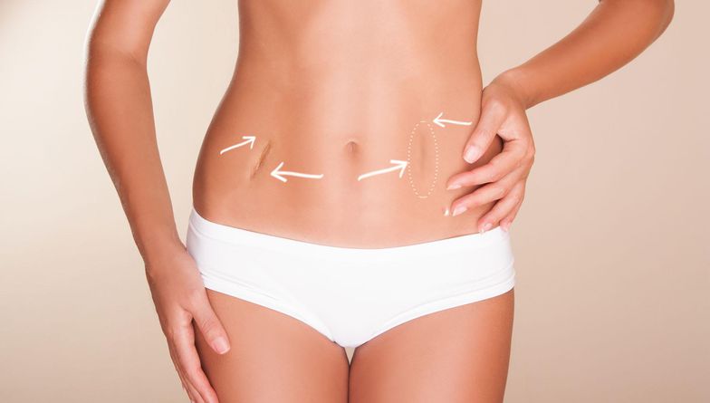 scar revision surgery