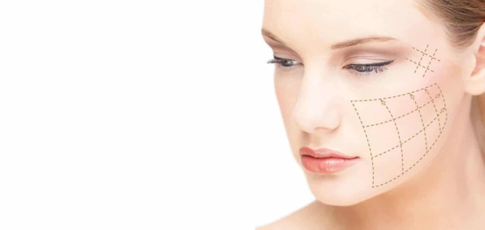 threadlift murah