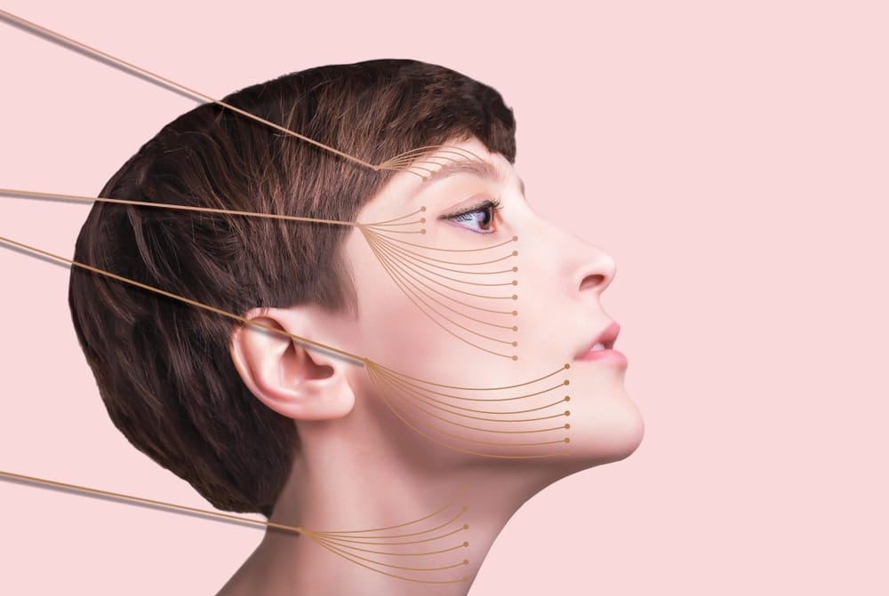 Threadlift