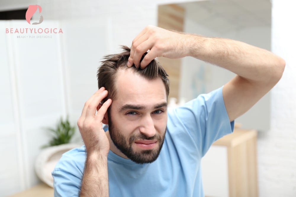 Cara Menebalkan Rambut Pria dengan Cepat dan Aman