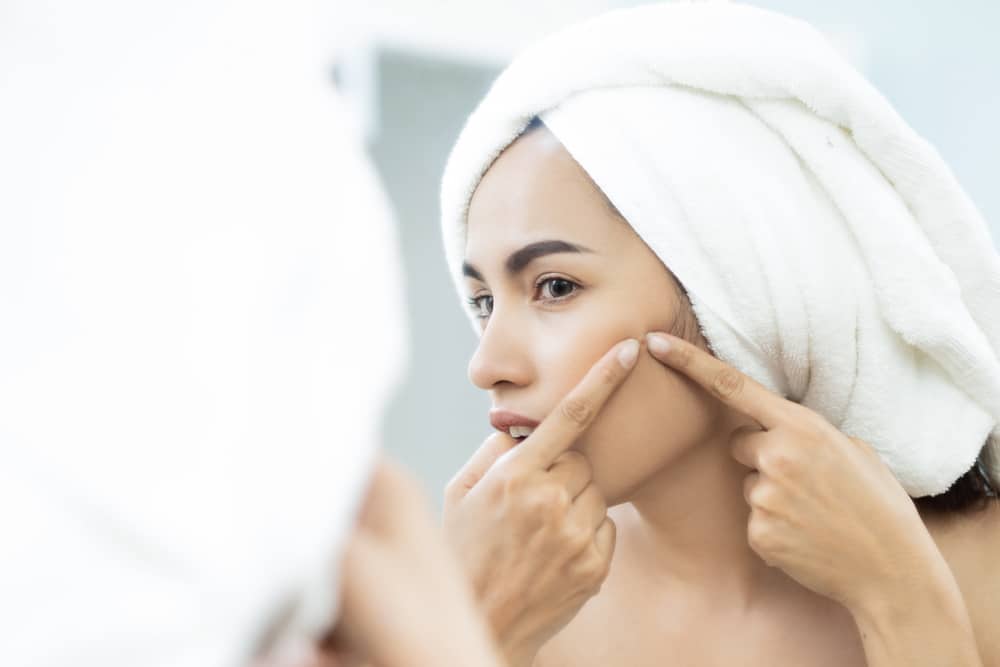 Tips Agar Bopeng di Wajah Tidak Semakin Parah