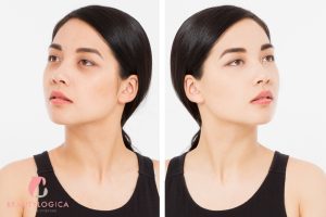 Perbedaan Kantung Mata dan Mata Panda