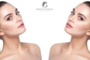 Filler Bibir Before After di Klinik Kecantikan