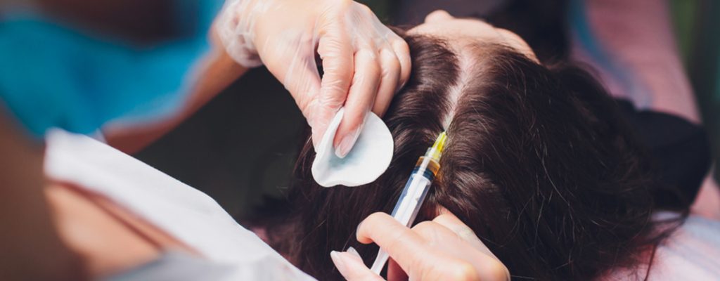 PRP Hair Treatment PRP Hair Treatment