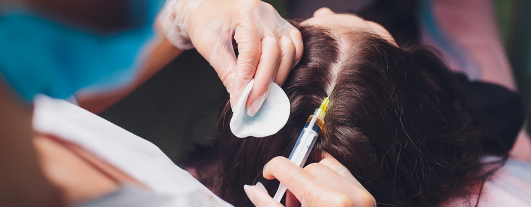 PRP Hair Treatment PRP Hair Treatment