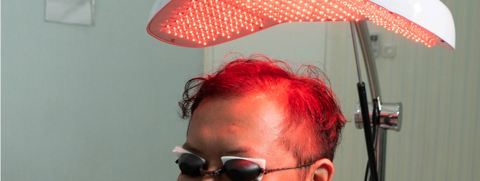 Hair Laser PDT - Terapi Laser Penumbuh Rambut Hair Laser PDT - Terapi Laser Penumbuh Rambut